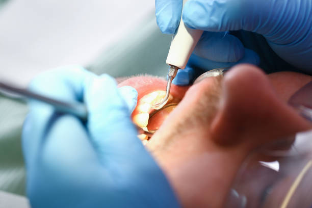Best Weekend Emergency Dentist in Wilson, OK