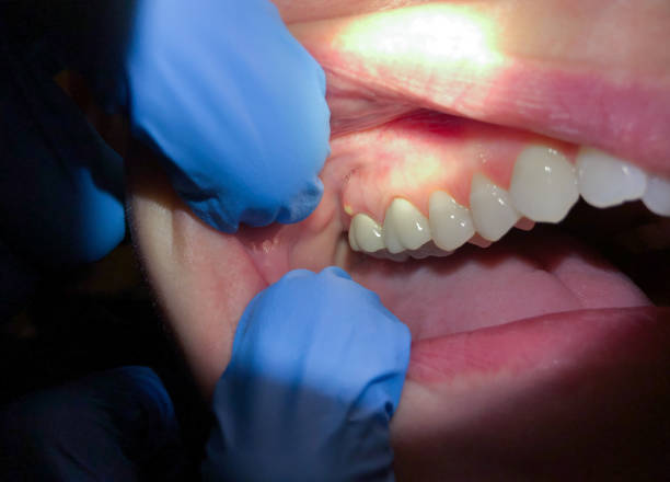 Best Weekend Emergency Dentist in Wilson, OK