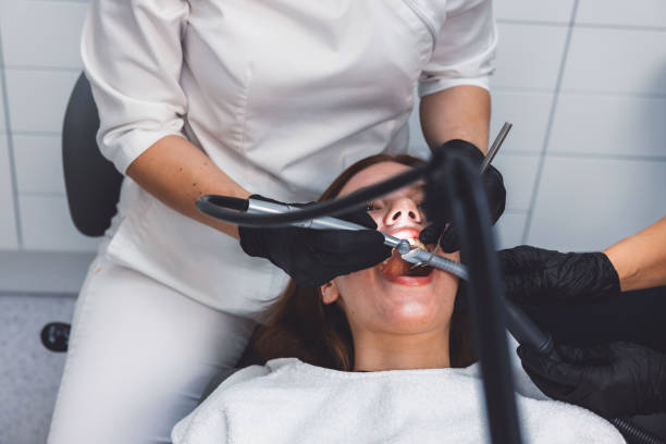 Best Emergency Wisdom Teeth Removal in Wilson, OK